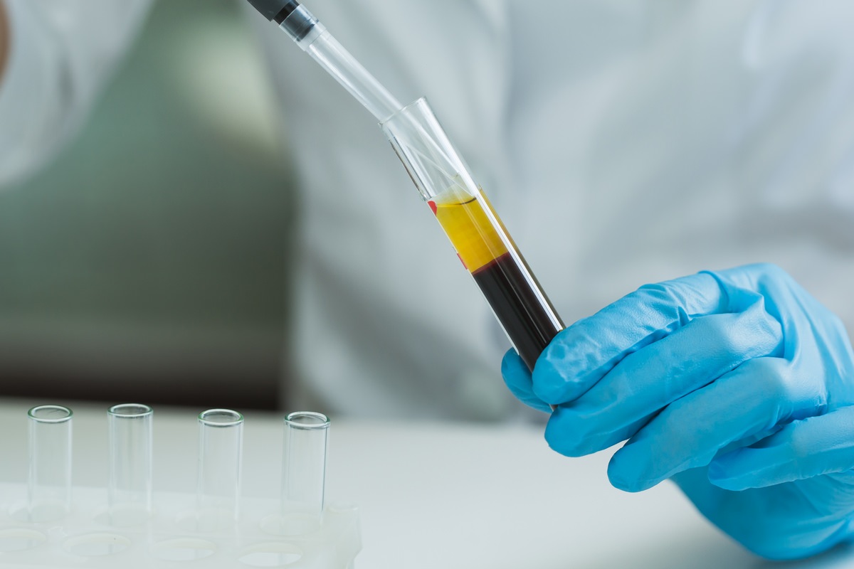 Плазмолифтинг: эликсир молодости или опасная процедура