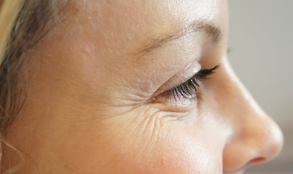 Морщины вокруг глаз? Проблема решаема!