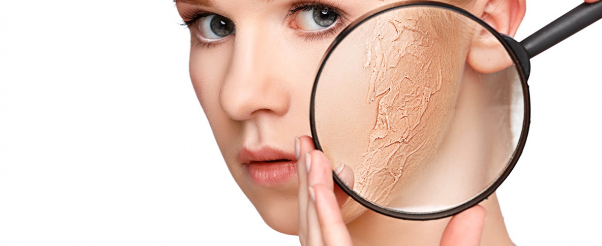 Как избавиться от сухости кожи?