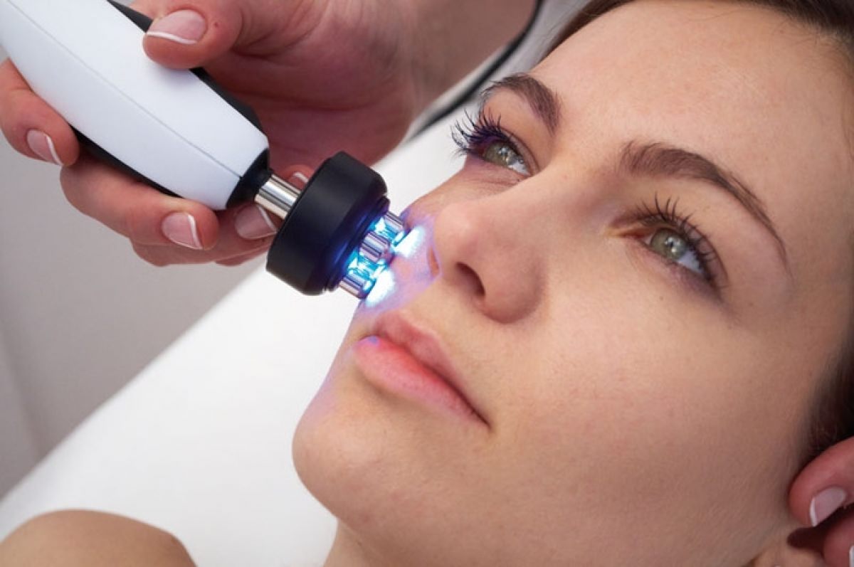 Радиолифтинг. То, что нужно женщине после 40