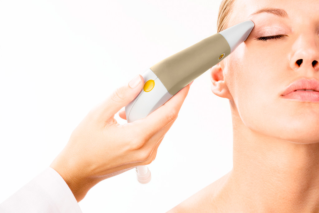 Радиолифтинг. То, что нужно женщине после 40