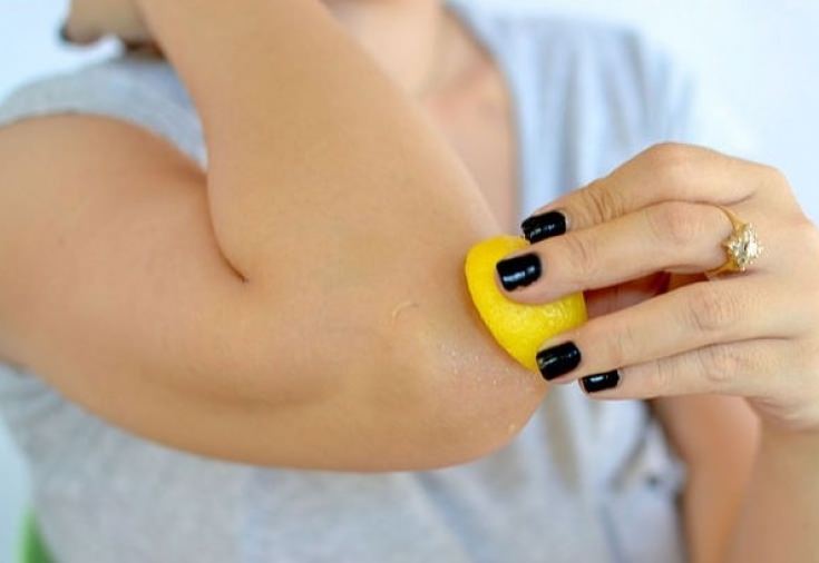 Самые эффективные методы избавления от сухости локтей и коленей