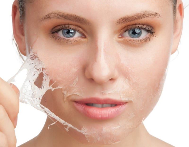 Навсегда отказаться от пилинга лица: 5 причин против очищения