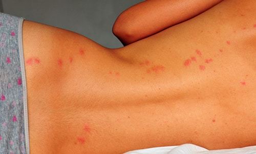 Ацекардол или кардиомагнил: что лучше и в чем разница (отличие составов, отзывы врачей)