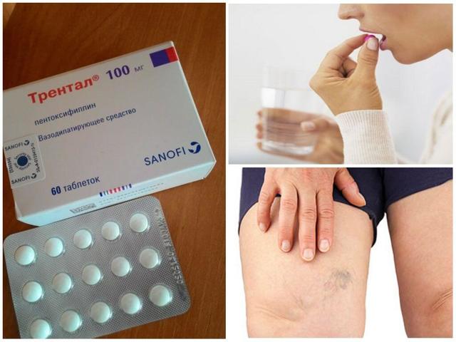 Агапурин и трентал: что лучше и в чем разница (отличие составов, отзывы врачей)