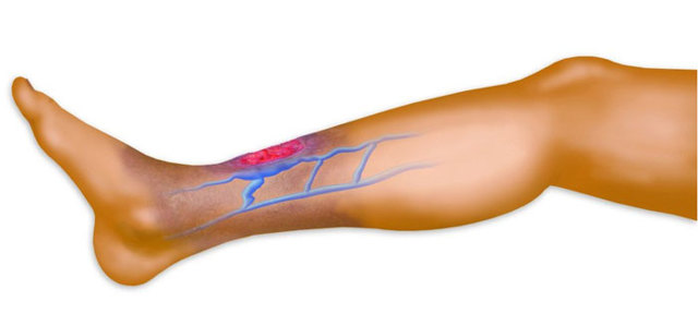 Агапурин и трентал: что лучше и в чем разница (отличие составов, отзывы врачей)