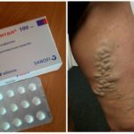 Агапурин и трентал: что лучше и в чем разница (отличие составов, отзывы врачей)