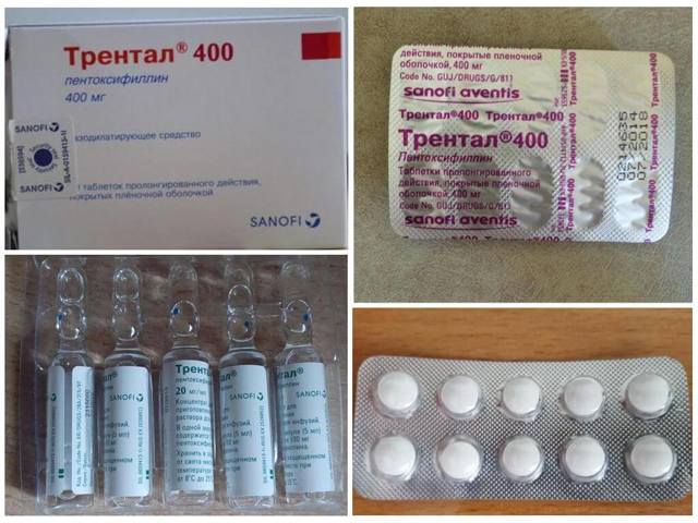 Агапурин и трентал: что лучше и в чем разница (отличие составов, отзывы врачей)