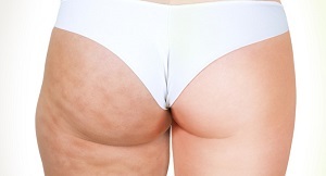 Аппарат для лимфодренажа: показания, противопоказания, виды аппаратов (для ног, рук), как выбрать для домашнего использования, отзывы