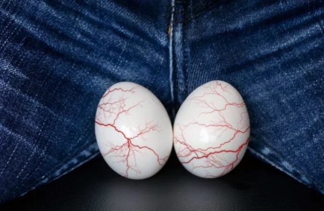 Бесплодие при варикоцеле: причины, лечение и можно ли забеременеть