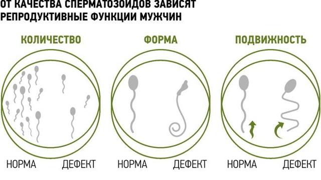 Бесплодие при варикоцеле: причины, лечение и можно ли забеременеть