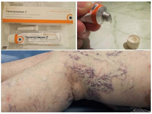 Безорнил и гепатромбин: что лучше и в чем разница (отличие составов, отзывы врачей)