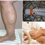 Безорнил и гепатромбин: что лучше и в чем разница (отличие составов, отзывы врачей)