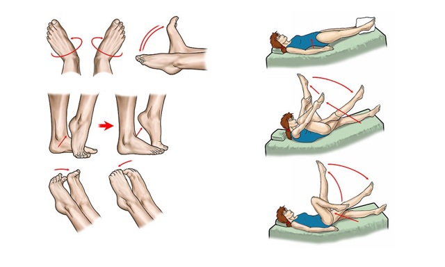 Боли в ногах при варикозе: симптомы (как болит), почему и как обезбаливать