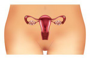 Что такое варикоз матки: как лечить,чем опасен, причины