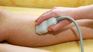 Дарсонваль при варикозе: как пользоваться, противопоказания, отзывы