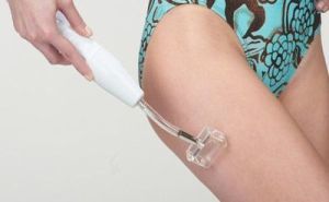 Дарсонваль при варикозе: как пользоваться, противопоказания, отзывы