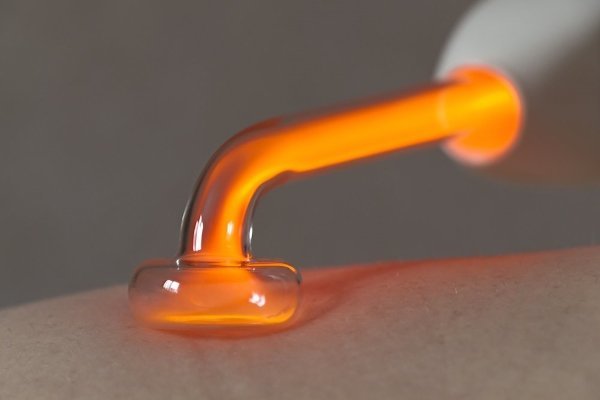 Дарсонваль при варикозе: как пользоваться, противопоказания, отзывы