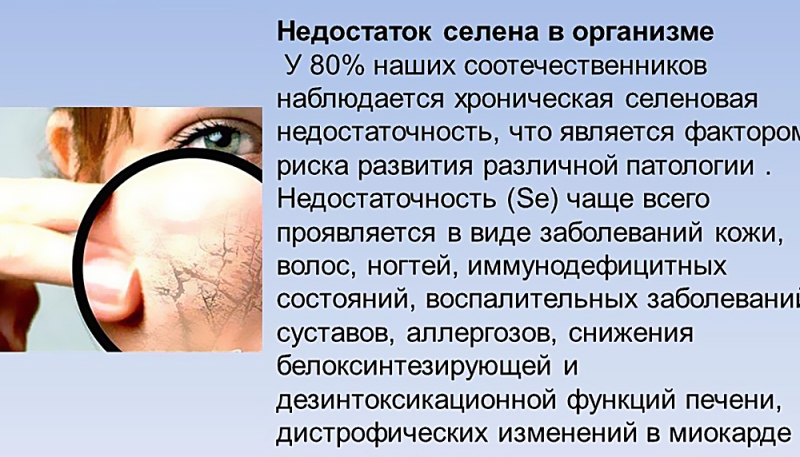 Дефицит селена в организме симптомы