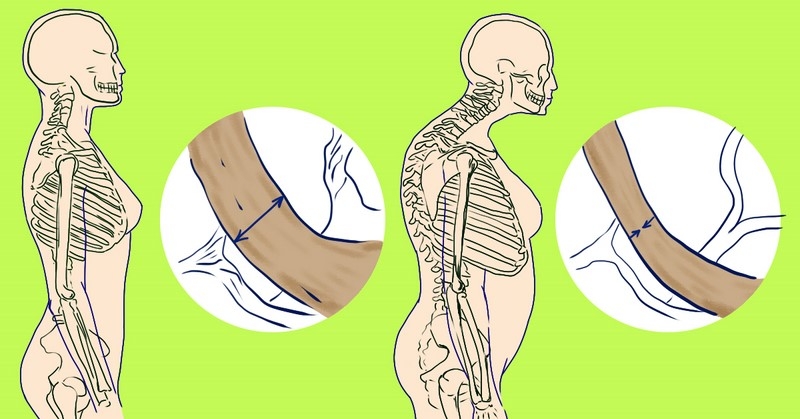 Дефицит витамина д у женщин