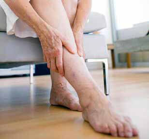 Диета при тромбофлебите глубоких вен нижних конечностей