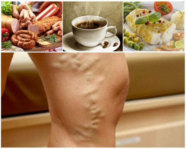 Диета при варикозе: правильное питание(что можно, что нельзя), меню на неделю