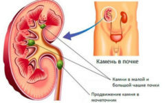 Диета при варикозе: правильное питание(что можно, что нельзя), меню на неделю