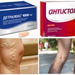 Эндотенол и антистакс: что лучше и в чем разница (отличие составов, отзывы врачей)