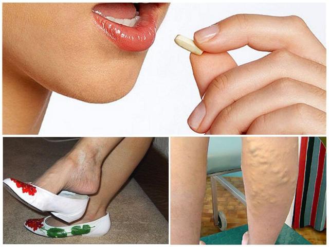 Эндотенол и антистакс: что лучше и в чем разница (отличие составов, отзывы врачей)