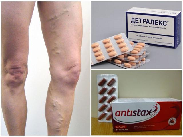 Эндотенол и антистакс: что лучше и в чем разница (отличие составов, отзывы врачей)