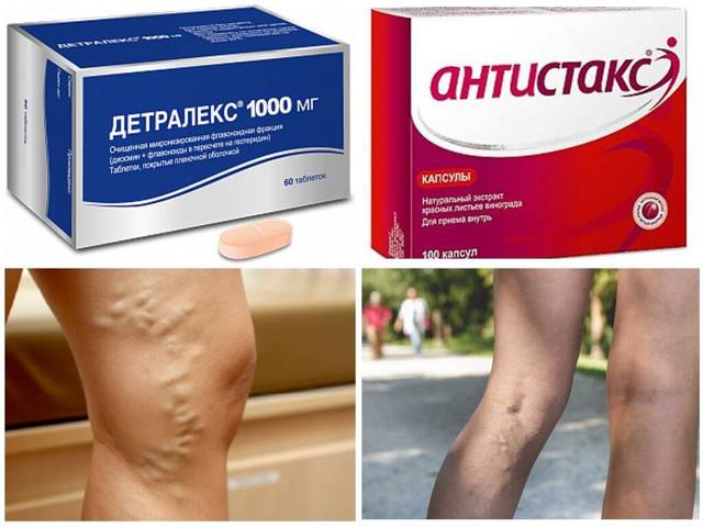 Эндотенол и антистакс: что лучше и в чем разница (отличие составов, отзывы врачей)