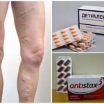 Эндотенол и антистакс: что лучше и в чем разница (отличие составов, отзывы врачей)