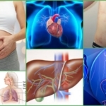 Флебэктомия (венэктомия): виды и ход операции, послеоперационный период, показания