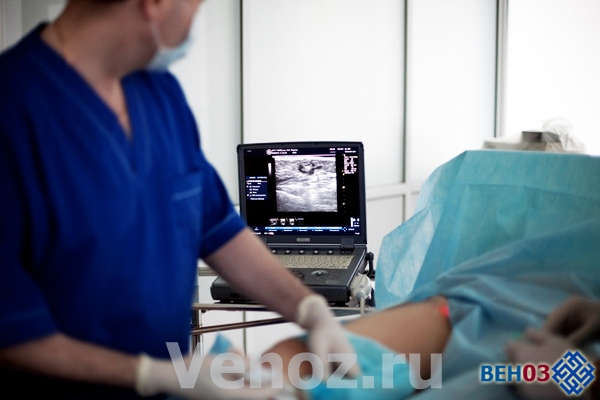 Флебэктомия (венэктомия): виды и ход операции, послеоперационный период, показания