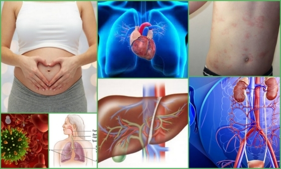 Флебэктомия (венэктомия): виды и ход операции, послеоперационный период, показания