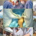 Флебэктомия (венэктомия): виды и ход операции, послеоперационный период, показания