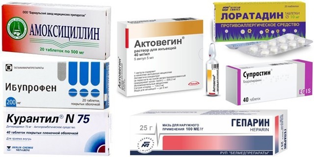 Флебит (воспаление) вены на руке: лечение