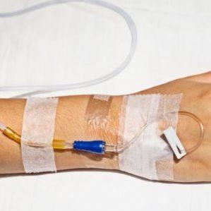 Флебит (воспаление) вены на руке: лечение