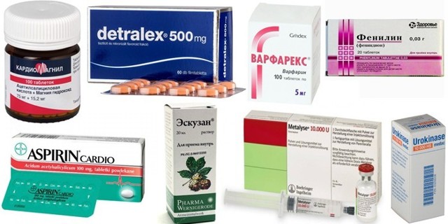 Флебит (воспаление) вены на руке: лечение