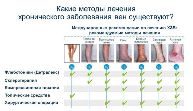 Флеботоники: что это за препараты, когда назначают, список, отзывы