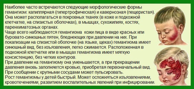 Гемангиома на голове у новорожденного ребенка: причины, диагностика, лечение, осложнения