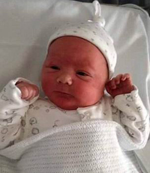 Гемангиома на голове у новорожденного ребенка: причины, диагностика, лечение, осложнения