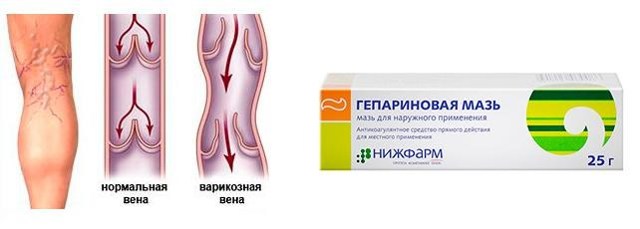 Гепариновая мазь при варикозе – инструкция по применению, отзывы, аналоги, форма выпуска, побочные действия, противопоказания, цена