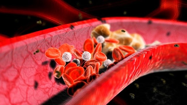Гепариновая мазь при варикозе – инструкция по применению, отзывы, аналоги, форма выпуска, побочные действия, противопоказания, цена