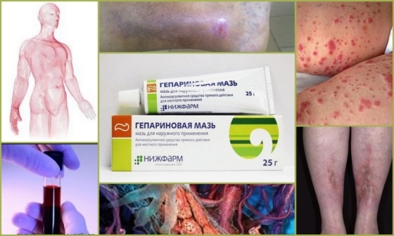 Гепатромбин г и гепариновая мазь: что лучше и в чем разница (отличие составов, отзывы врачей)