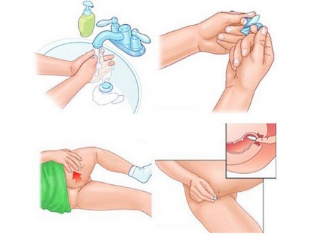 Гепатромбин г и гепариновая мазь: что лучше и в чем разница (отличие составов, отзывы врачей)