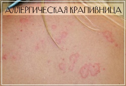 Гепатромбин г и гепариновая мазь: что лучше и в чем разница (отличие составов, отзывы врачей)