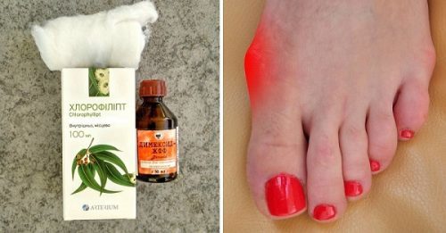 Хлорофиллипт и димексид – можно ли принимать одновременно (совместимость)