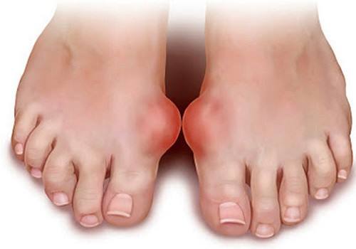 Хлорофиллипт и димексид – можно ли принимать одновременно (совместимость)