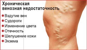 Хроническая венозная недостаточность (хвн) 1,2,3 степени: причины, симптомы, классификация сеар, лечение, профилактика, последствия